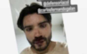 Grave denuncia de Homofobia: Joven atacado por Conductores del SITP en Kennedy, le dejaron varias fracturas Edward Leonardo Rodríguez ataque homofóbico SITP